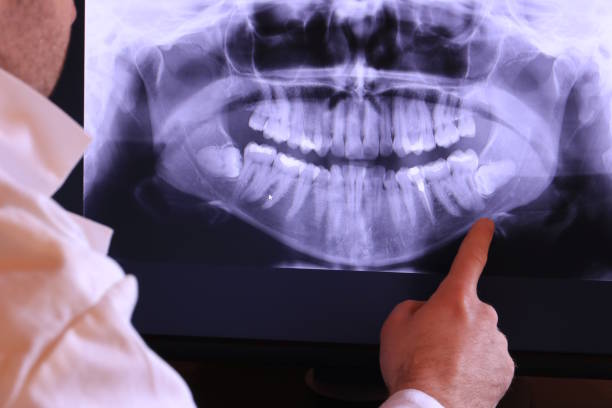 Best Emergency Tooth Extraction in Clinton, OK