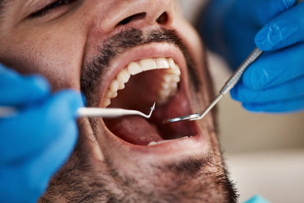 Best Emergency Root Canal Treatment in Clinton, OK