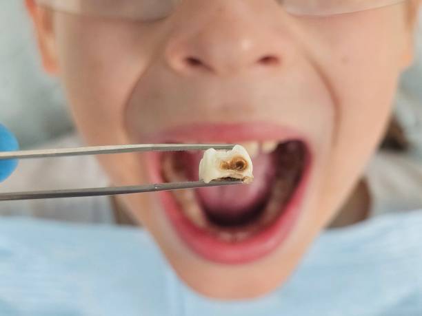 Best Emergency Denture Repair in Clinton, OK