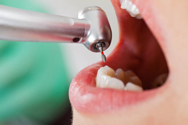 Best Weekend Emergency Dentist in Clinton, OK